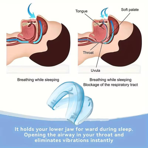 SleepEasy Snore Guard
